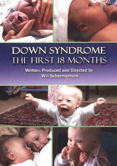 Schermerhorn, W: Down Syndrome DVD
