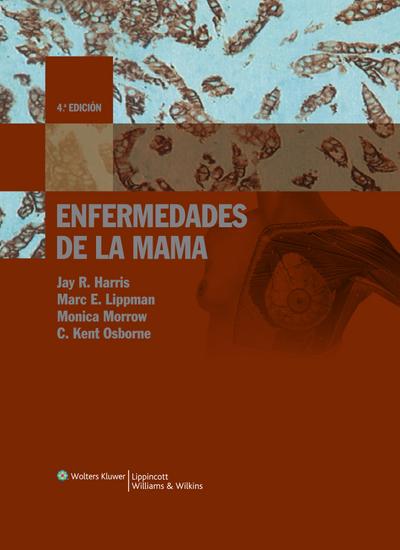 Harris, J: Enfermedades de la mama
