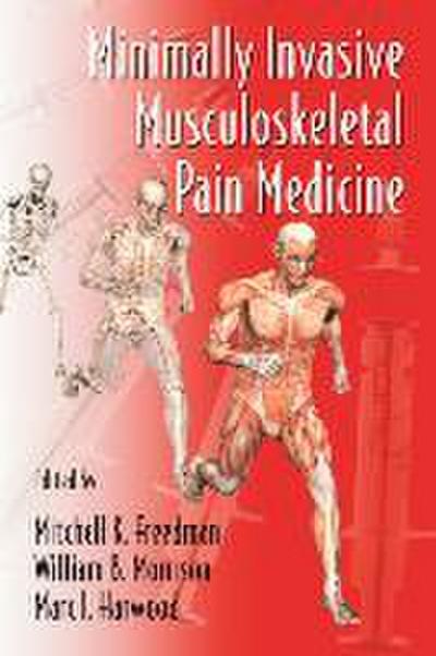 Minimally Invasive Musculoskeletal Pain Medicine