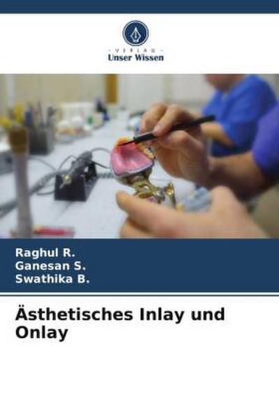 Ästhetisches Inlay und Onlay