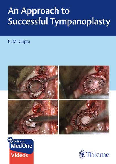 An Approach to Successful Tympanoplasty