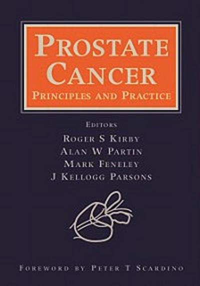 Prostate Cancer