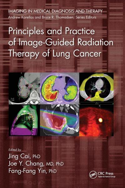 Principles and Practice of Image-Guided Radiation Therapy of Lung Cancer