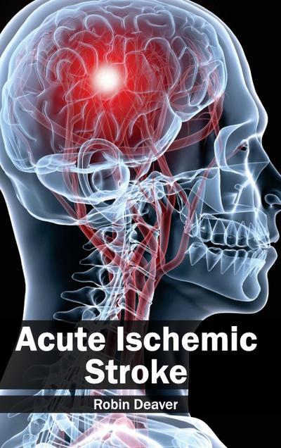 Acute Ischemic Stroke