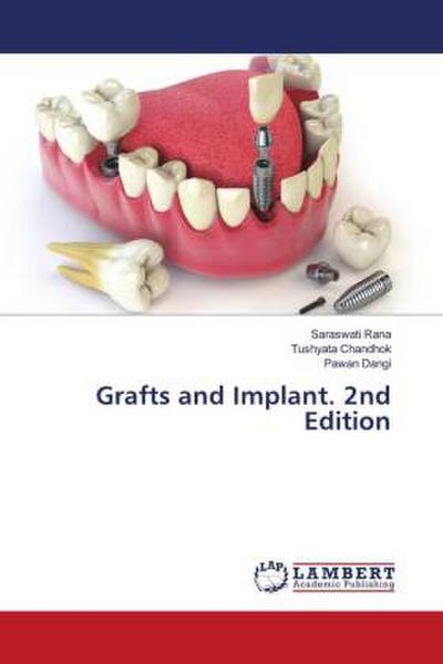 Grafts and Implant. 2nd Edition