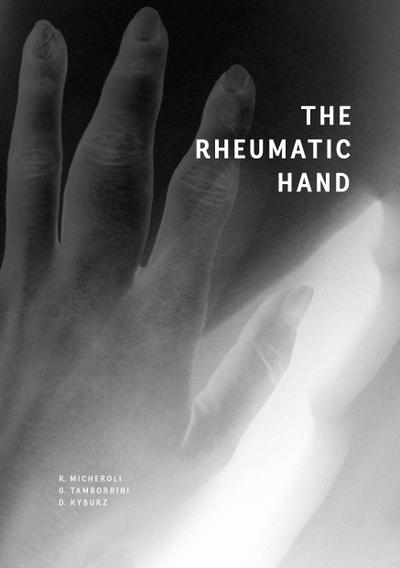 The Rheumatic Hand