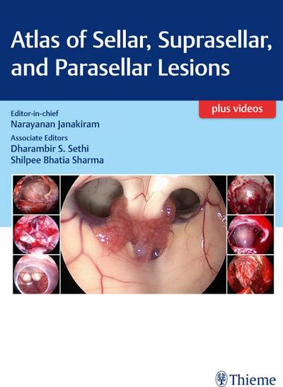 Atlas of Sellar, Suprasellar, and Parasellar Lesions