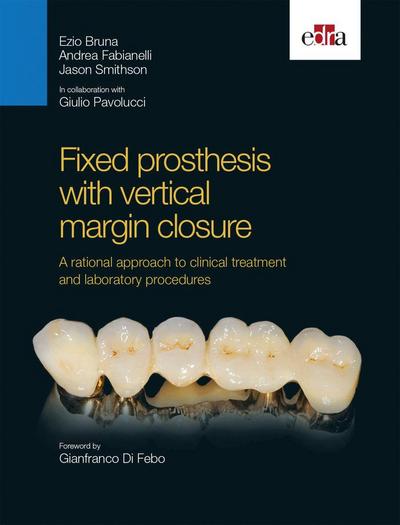 Fixed Prosthesis with Vertical Margin Closure. a Rational Approach to Clinical Treatment and Laboratory Procedures