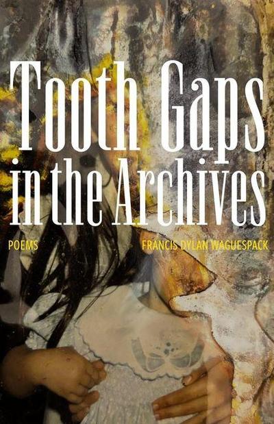 Tooth Gaps in the Archives