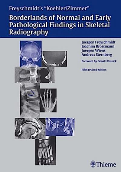 Borderlands of Normal and Early Pathologic Findings in Skeletal Radiograph
