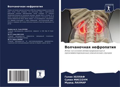 Volchanochnaq nefropatiq