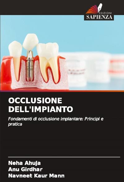 OCCLUSIONE DELL’IMPIANTO