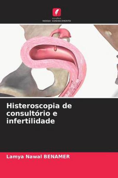 Histeroscopia de consultório e infertilidade