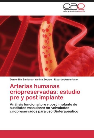 Arterias humanas criopreservadas: estudio pre y post implante