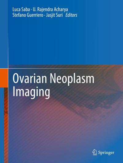 Ovarian Neoplasm Imaging