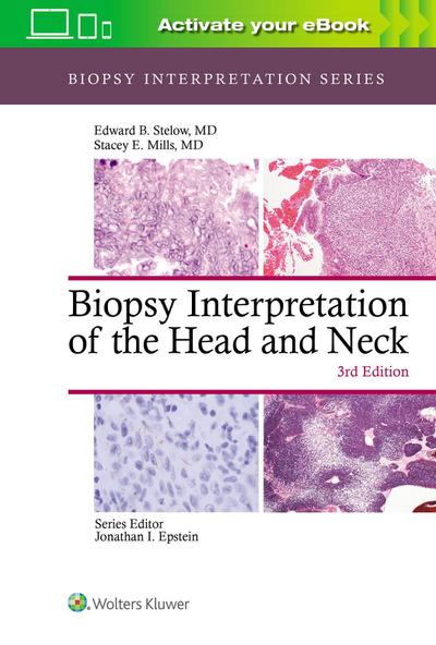 Biopsy Interpretation of the Head and Neck