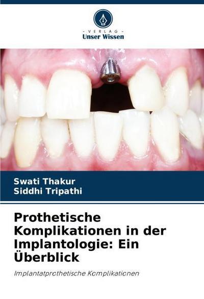 Prothetische Komplikationen in der Implantologie: Ein Überblick