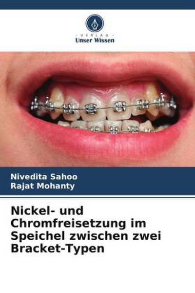 Nickel- und Chromfreisetzung im Speichel zwischen zwei Bracket-Typen