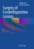 Surgery of Cerebellopontine Lesions