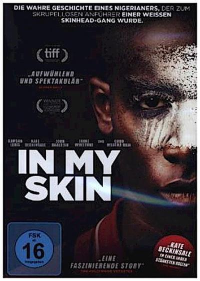 In my Skin