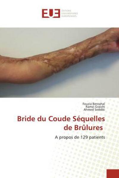 Bride du Coude Séquelles de Brûlures