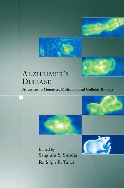Alzheimer’s Disease