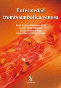 Enfermedad tromboembólica venosa