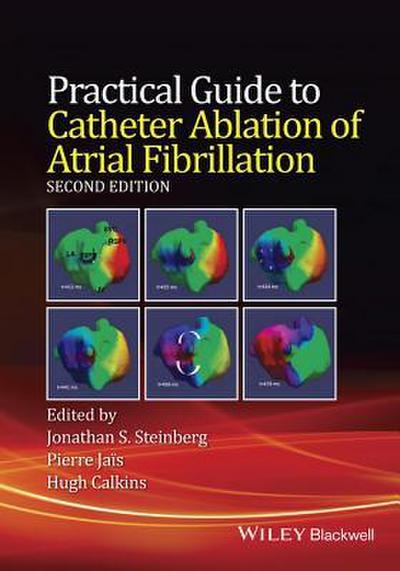 Practical Guide to Catheter Ablation of Atrial Fibrillation