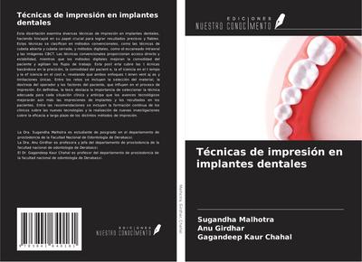 Técnicas de impresión en implantes dentales