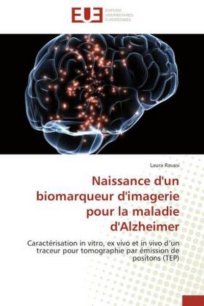 Naissance d’un biomarqueur d’imagerie pour la maladie d’Alzheimer