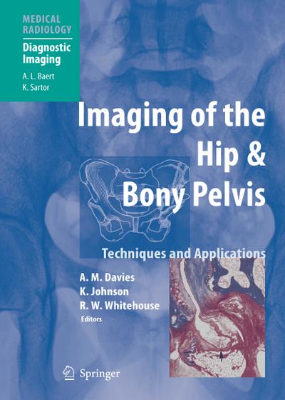 Imaging of the Hip & Hip and Bony Pelvis
