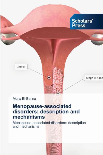 Menopause¿associated disorders: description and mechanisms