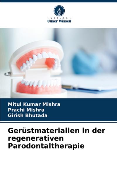 Gerüstmaterialien in der regenerativen Parodontaltherapie
