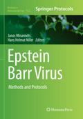 Epstein Barr Virus