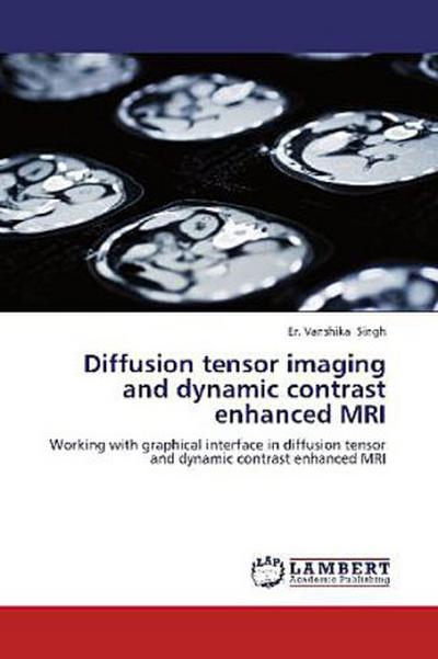 Diffusion tensor imaging and dynamic contrast enhanced MRI