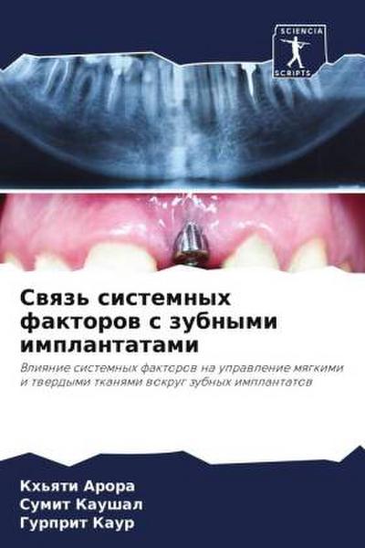 Swqz’ sistemnyh faktorow s zubnymi implantatami