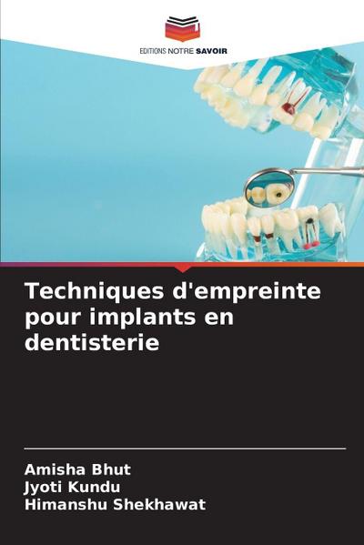 Techniques d’empreinte pour implants en dentisterie