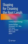 Shaping for Cleaning the Root Canals