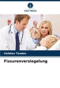 Fissurenversiegelung
