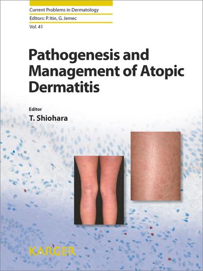 Pathogenesis and Management of Atopic Dermatitis