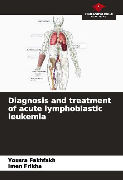 Diagnosis and treatment of acute lymphoblastic leukemia