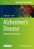 Alzheimer’s Disease