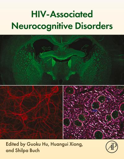 HIV-Associated Neurocognitive Disorders