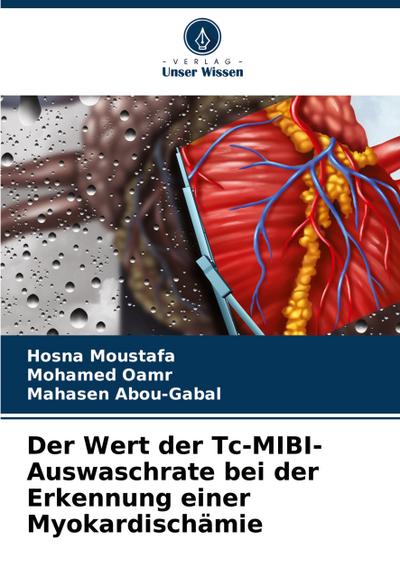 Der Wert der Tc-MIBI-Auswaschrate bei der Erkennung einer Myokardischämie