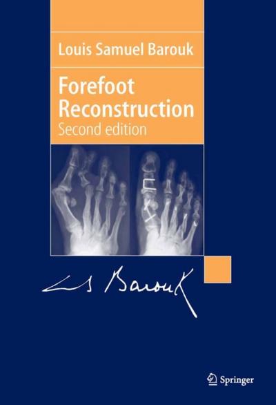 Forefoot Reconstruction