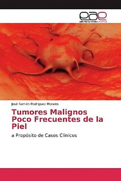 Tumores Malignos Poco Frecuentes de la Piel