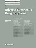 Adverse Cutaneous Drug Eruptions