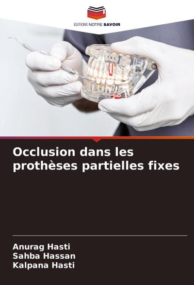 Occlusion dans les prothèses partielles fixes