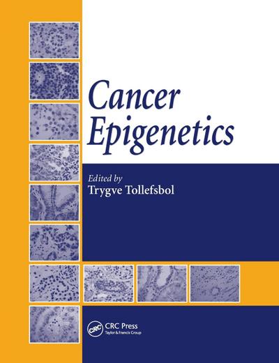 Cancer Epigenetics