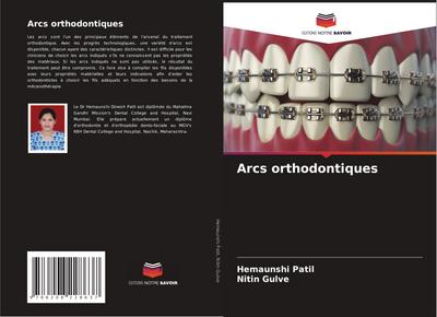 Arcs orthodontiques